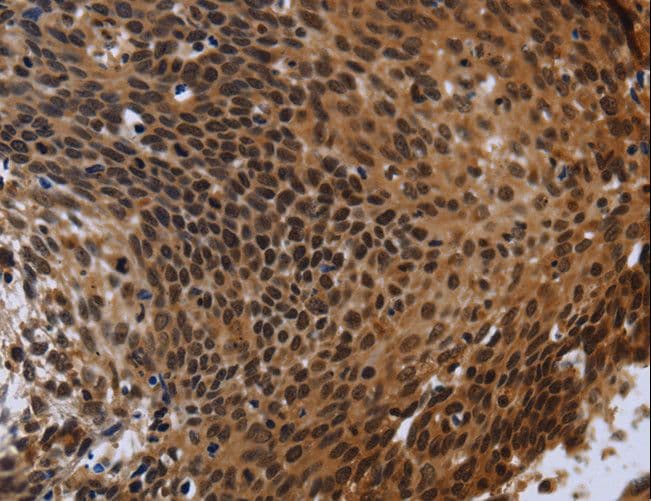 FHL3 Antibody