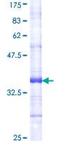 Human INSR / Insulin Receptor Protein (Recombinant GST, N-terminus)