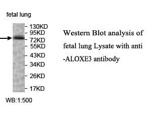 ALOXE3 Antibody (aa334-599)