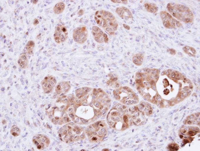 DDT / Dopamine Tautomerase Antibody (aa1-118)