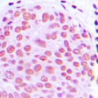Polyclonal Rabbit anti-Human JUN / c-Jun Antibody (Internal, IHC, WB)