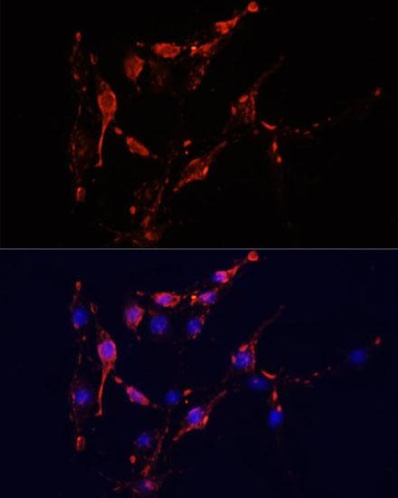 ICAM-1 / CD54 Antibody