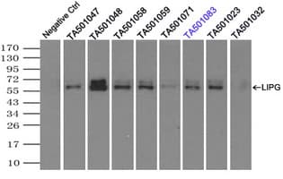 LIPG / Endothelial Lipase Antibody (clone OTI4D2, Carrier-free)