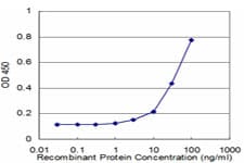 Monoclonal Mouse anti-Human S100P Antibody (clone 4E7, aa1-95, IF, WB)