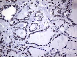 NBN / Nibrin Antibody (clone OTI8E6)
