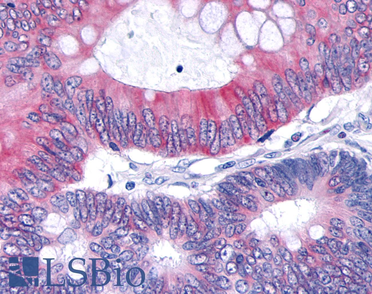 PathPlus™ TNIK Antibody (Internal)