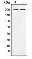 Polyclonal Rabbit anti-Human TNS1 / Tensin-1 Antibody (phospho-Tyr1326, WB)