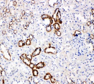 Polyclonal Rabbit anti-Mouse SLC2A5 / GLUT5 Antibody (aa232-251, IHC, WB)
