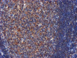 CYB5R3 / B5R Antibody (clone OTI1E8)