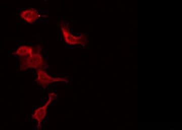 Polyclonal Rabbit anti-Human WASF1 / WAVE Antibody (IHC, IF, WB)
