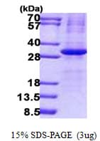 Human IL34 Protein (Recombinant His)