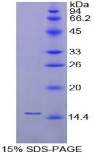 Chicken FABP1 / L-FABP Protein (Recombinant His)