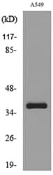 SLC10A1 / NTCP Antibody