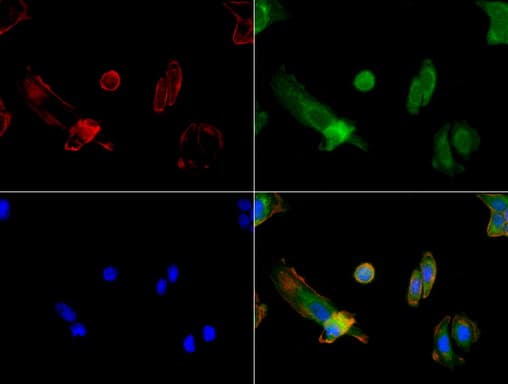 FOLH1 / PSMA Antibody (clone UMAB25, Carrier-free)