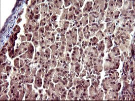 Monoclonal Mouse anti-Human UPRT Antibody (clone OTI1C9, IHC, WB)