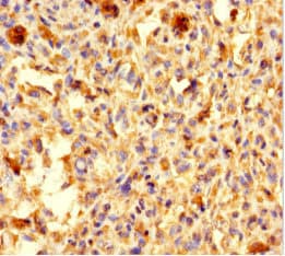 ALS2CR11 Antibody