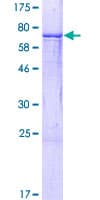 Human ABHD8 Protein (Recombinant GST)