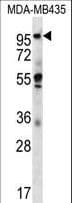 CTAGE5 Antibody (aa775-804)