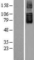SLC26A6 / PAT1 Protein (Over-Expression Lysate Myc-DDK (Flag))