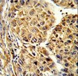 Polyclonal Rabbit anti-Human CYP2C19 Antibody (aa82-108, IHC, IF, WB)