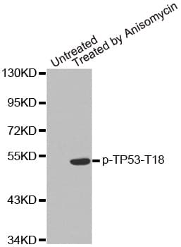 TP53 / p53 Antibody (phospho-Thr18)