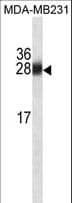 GSTM1 Antibody (aa184-211)