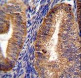 Polyclonal Rabbit anti-Human SGSM2 Antibody (aa955-984, IHC, WB)