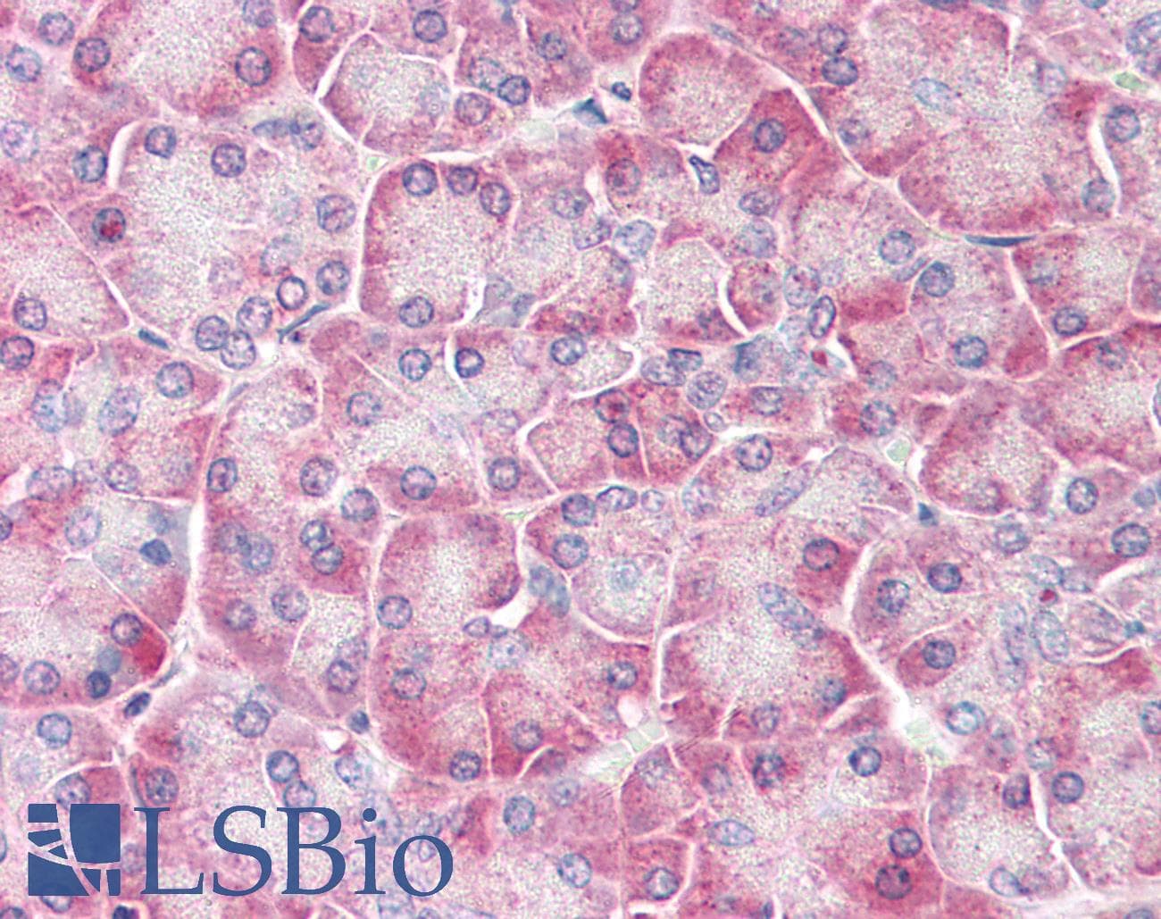 IHC-plus™ IRAK2 / IRAK-2 Antibody