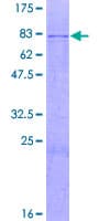 Human GALNS / Chondroitinase Protein (Recombinant GST)