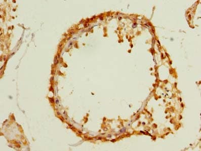 Polyclonal Rabbit anti-Human MFAP3L / NYD-Sp9 Antibody (IHC)