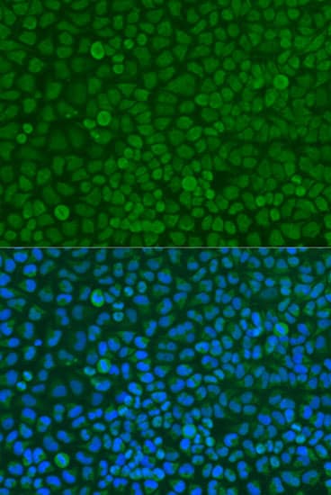 Polyclonal Rabbit anti-Human YWHAZ / 14-3-3 Zeta Antibody (IF, WB)