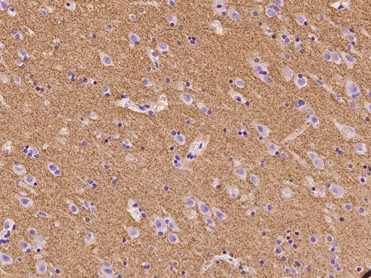 SLC17A7 / VGLUT1 Antibody