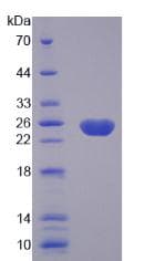 Human CASP8 / Caspase 8 Protein (Recombinant His-T7)