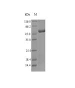 Dermatophagoides farinae TPM1 / Tropomyosin Protein (Recombinant 6His-SUMO, N-terminus)