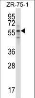 RPS6KB1 / P70S6K / S6K Antibody (aa481-509)