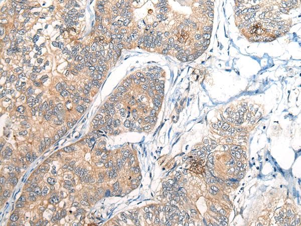 BCAN / Brevican Antibody