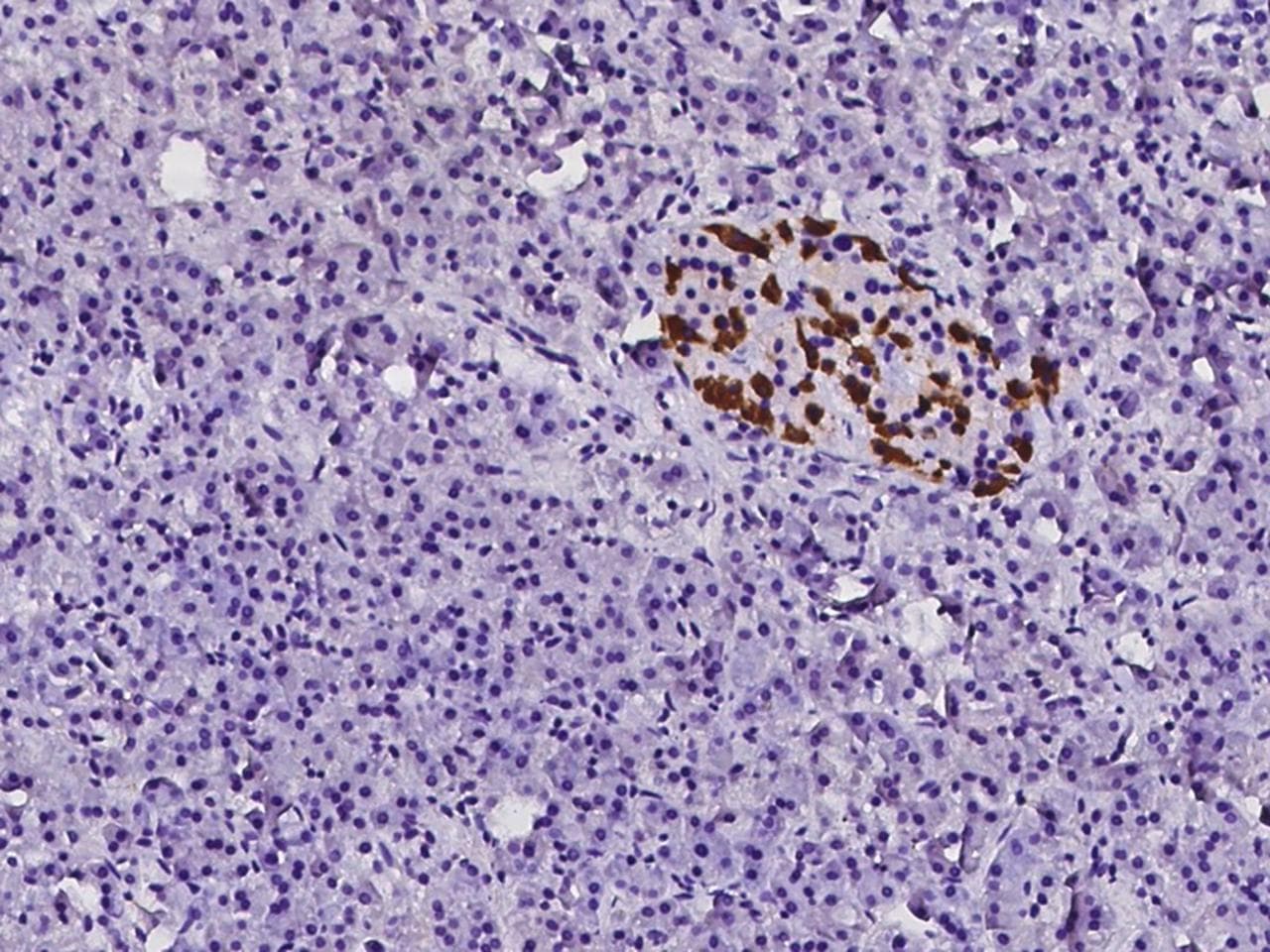 TTR / Transthyretin Antibody