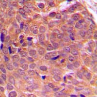 Polyclonal Rabbit anti-Human AKT1 + AKT2 + AKT3 Antibody (Internal, IHC, WB)