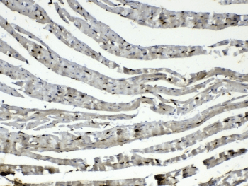 Polyclonal Rabbit anti-Human CYGB / Cytoglobin Antibody (IHC, WB)
