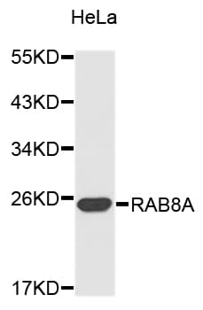 Polyclonal Rabbit anti-Human RAB8A / RAB8 Antibody (WB)