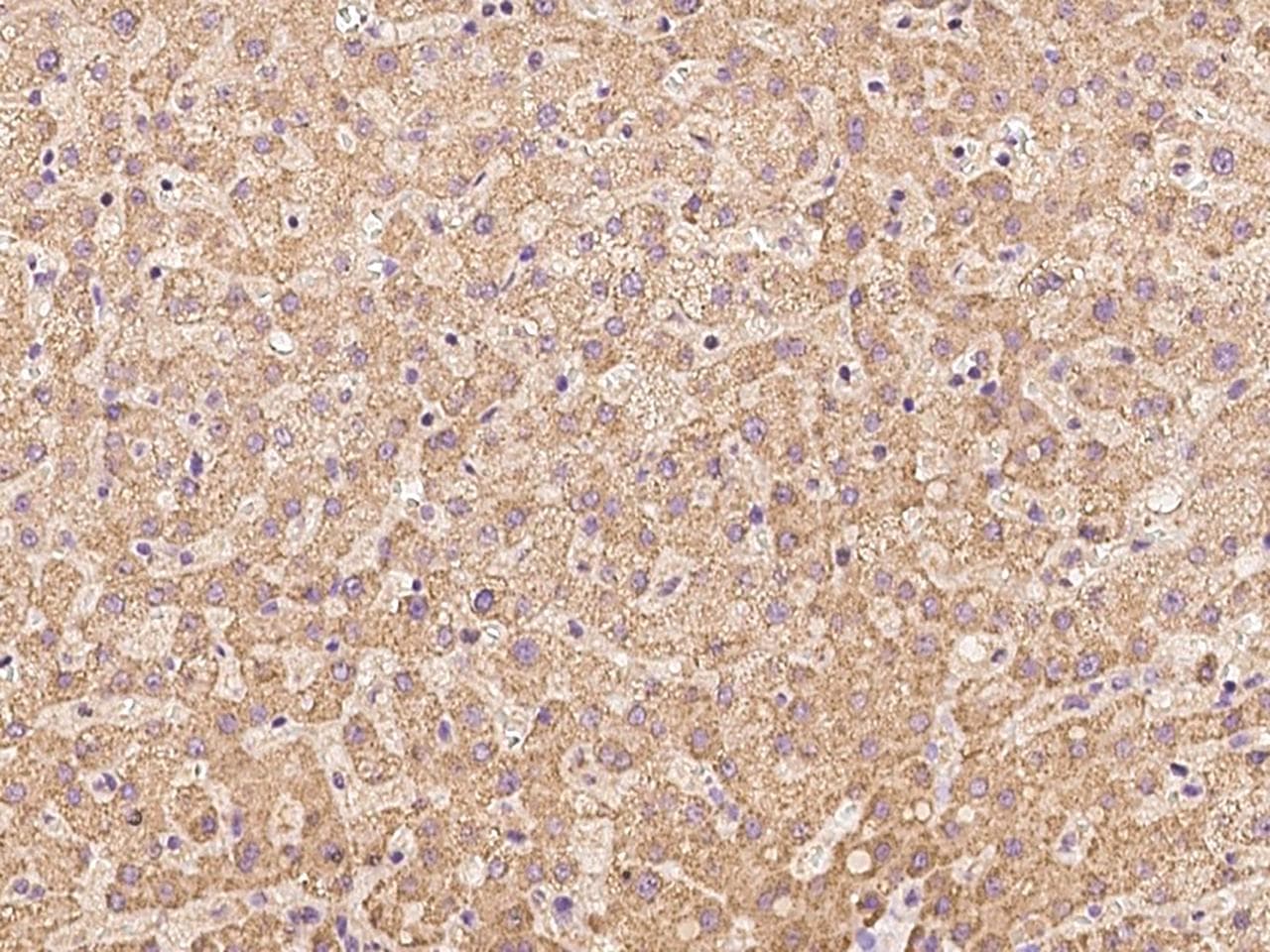 CCDC67 Antibody