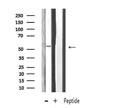 MMP13 Antibody