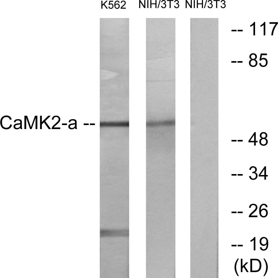 CaMKII Alpha+Delta Antibody (Internal)