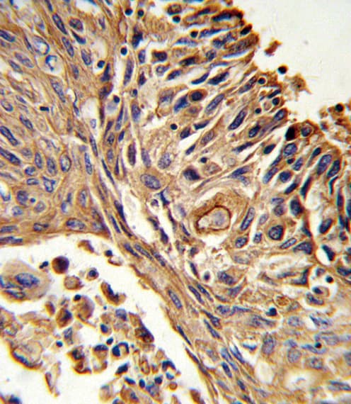 AcPL / IL18RAP Antibody (aa73-101)