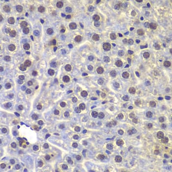 Polyclonal Rabbit anti-Human FUBP3 Antibody (IHC, WB)
