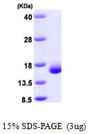 Human LGALS2 / Galectin 2 Protein (Recombinant His)