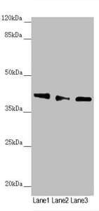 Polyclonal Rabbit anti-Human DYNC2LI1 / D2LIC Antibody (IHC, WB)
