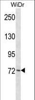 PLK3 Antibody (aa33-61)