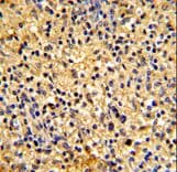 DEC-205 / CD205 / LY75 Antibody (aa646-675)