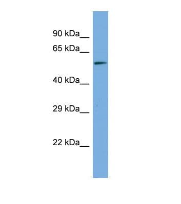 Polyclonal Rabbit anti-Human MAGED2 Antibody (aa241-290, WB)